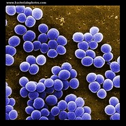 microscopy of staphylococcus aureus